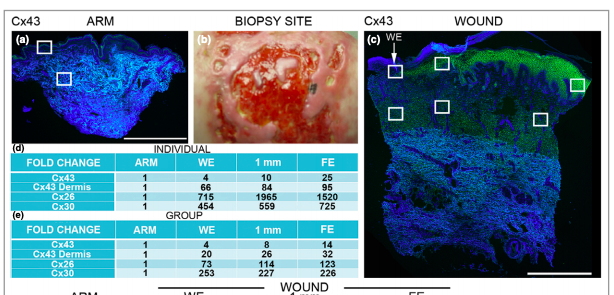 Abnormal Connexin Expression in Human Chronic Wounds